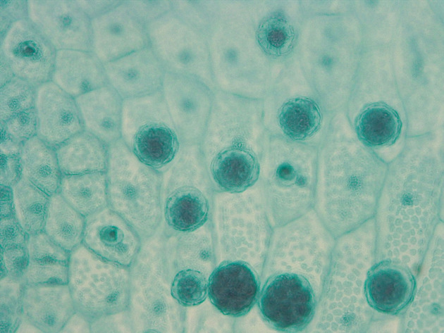 Fern Gametophyte Slides - Ferngametophyte 01 400X